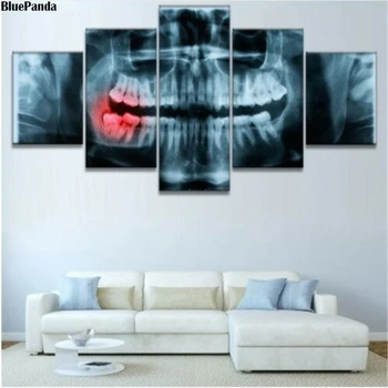 Panoramic Dental X-Ray 5 Piese Moderne Panza Pictura Ulei de Imprimare Poster HD a Imaginii Pentru Camera de zi Office Home Decor