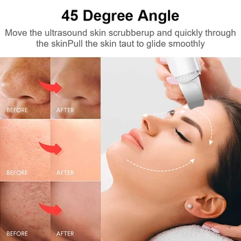 Cu Ultrasunete Skin Scrubber Aparat Peeling Facial Porilor Filtrului De Fata Skin Scrubber Ridica Masina Profundă Curățare Față