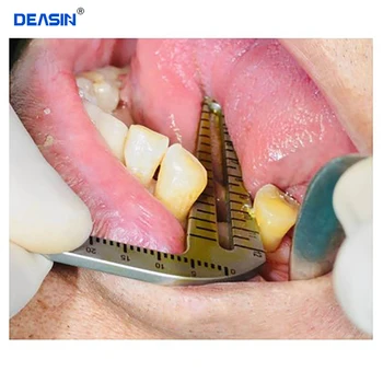 Implant Dentar Intervenție Chirurgicală Ghid De Localizare Instrumente Set Dinte De Măsurare Conducător Etriere Crestei Osoase Implant Dentar Locator L&S