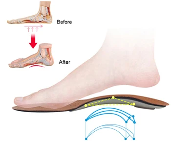 Piele Pantofi Ortopedici Unic Branțuri pentru Pantofi Femei Bărbați Picioare Plate Suport Arc OX Picior de Corecție Pad Fasciita Plantara Tălpi